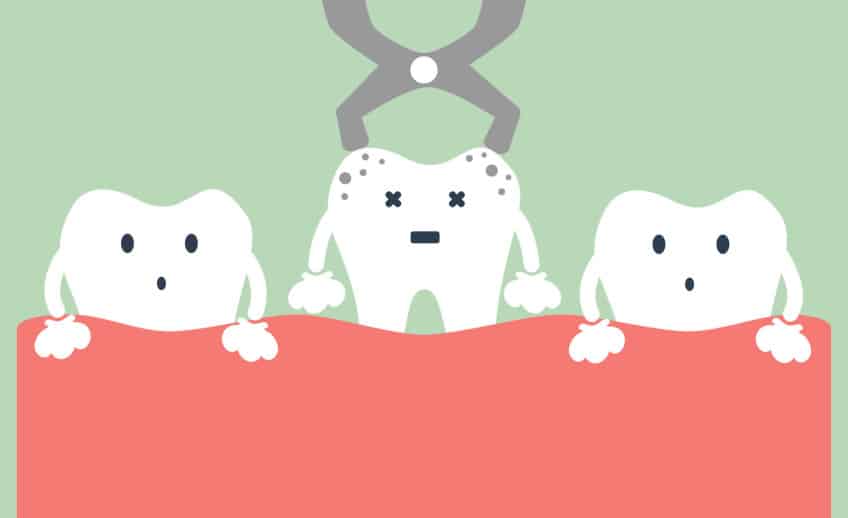 Tooth