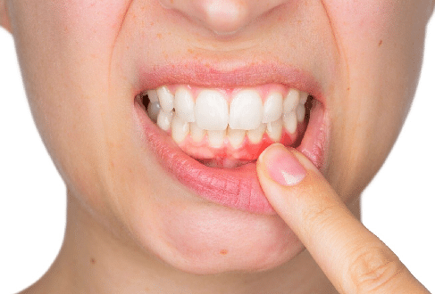 gums inflamed causes swollen dental them why