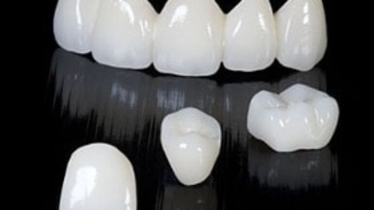 What are the best dental crowns you can get?