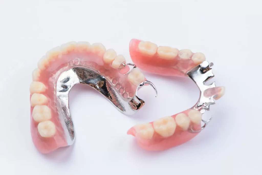 dentures metal partial