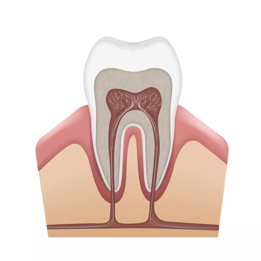 root canal procedure