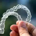 Retainers